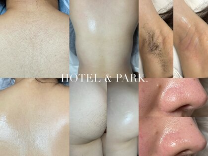 ホテルアンドパーク(HOTEL&PARK.)の写真