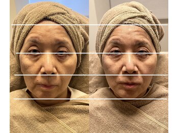 ビーマジック(Be Magic)/韓国最先端!NKソリューション