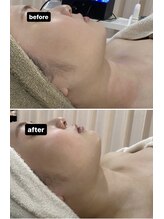 ドマーニ(Domani)/テラボーラーフェイシャル