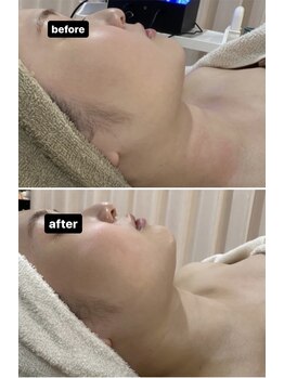 ドマーニ(Domani)/テラボーラーフェイシャル