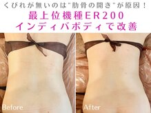 オリエンタルローザ 表参道(Oriental Rosa)/肋骨の開きを改善しクビレをGET