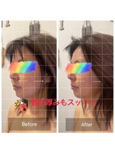 ハナン(Hanan)/ナノカレントで即日小顔に！