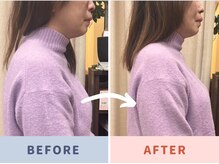 くすの木 治療院/猫背・肩こりダブルでスッキリ