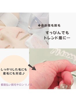 リノエ(lin'oe)/眉周り脱毛♪