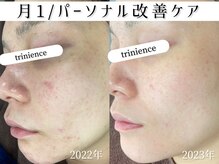 トリニエンス 南流山店の雰囲気（月1回集中肌改善/繰り返すお肌のお悩みレスキュー！）