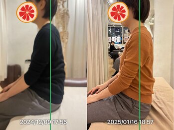 グレフル鍼灸接骨院 整体院 心斎橋/