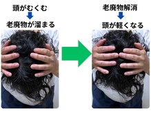 頭に溜まる老廃物を解消して頭痛・めまいを改善へ導きます