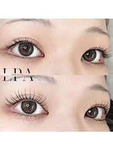 レピア 郡山駅前店/韓国式LEPIA Before&After