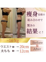 イーズ ミュゼ &nbsp;ららぽーと横浜店/短期集中ダイエット