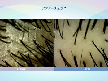 アンス(anth:)/お客様の仕上がり