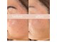ハナワビューティーサロン(HanaWa beauty salon)の写真