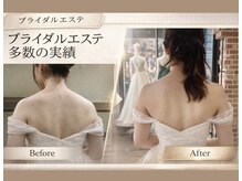 トータルエステサロン エステアンドメイク 錦糸町の雰囲気（気になる部位、全身痩せ！オーダーメイド痩身で最速結果出し）