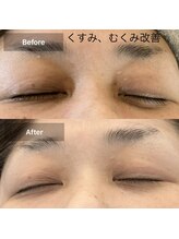 ルミエール(Lumiere)/５０代女性　くすみ、むくみ改善