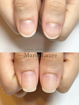 マリーロール 淀屋橋本店(Marie Laure)/自爪育成/深爪矯正/ネイルケア