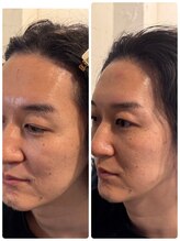 スリーピース(3Peace)/Before/After