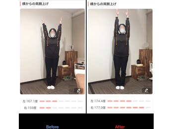 鹿児島整体院/首こり/肩こり/鹿児島/整体