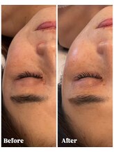 アールヨンマルハチ フェイスアンドアイ(R408.face&eye)/若々しいお肌に