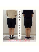 スタイルラボ高松/産後の骨盤矯正の効果♪