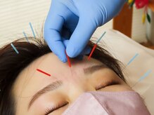 トーリ 代官山(taulli)の雰囲気（頭皮と前額部の鍼◎頭痛/眼精疲労/睡眠改善/鼻づまり/いびきケア）