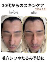 ルポ(Repos)/ブライダルシェービング