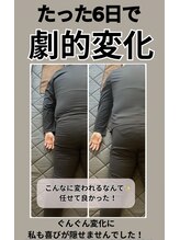 ヨサ パーク ルル(YOSA PARK Lulu)&nbsp;見た目痩せ から始まる