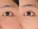 タム(TAM)の写真