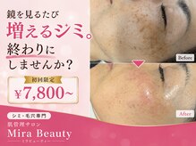 ミラビューティー(Mira Beauty)