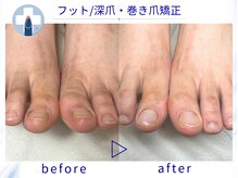 プラスワン(+1)の雰囲気（深爪・巻き爪、足のトラブルに対応☆フット深爪矯正[池袋]）