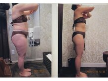 パーフェクトボディプレミアム 札幌駅前店(PERFECT BODY PREMIUM)/お客様　ビフォーアフター（11）