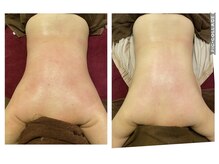 ボヌール(BONHEUR)/3.背中骨格トリートメント