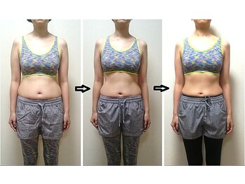 かんだ接骨院/40歳　骨盤ダイエット