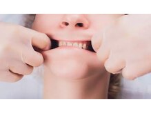 インフィニティ 名古屋金山(INFINITY)/名古屋初！口腔コルギが人気◎