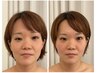 周年記念♪ 今だけLED&バストもふっくら美人バスト式コルギ¥16,500→￥9,800