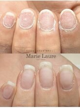 マリーロール 天王寺店(Marie Laure)/自爪育成/深爪矯正/ネイルケア