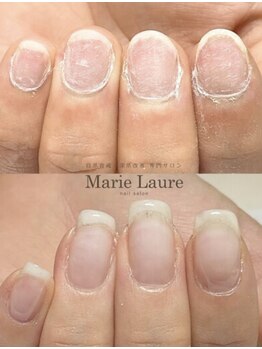 マリーロール 天王寺店(Marie Laure)/自爪育成/深爪矯正/ネイルケア