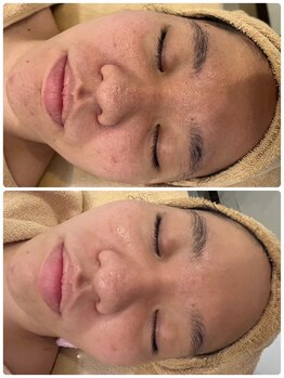 ディーキャットリー(D Catrry)/ハーフピーリング