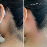 ソワン(soin)