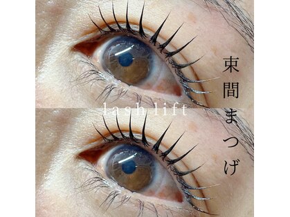 ディーロータス(D-lotus)の写真