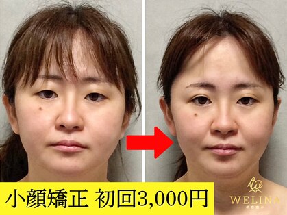 美容整体ウェリナ あま甚目寺院の写真