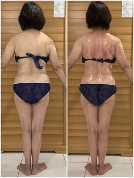 エゴ(EGO)/40代半ば 154.0cm 10.3キロ減