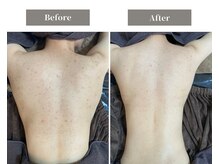 エミルカ 天王寺店(EMILUCA)の雰囲気（自社開発のハーブピーリングで回数を重ねるたびに理想のお肌へ！）