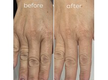 リムネイル(RIM NAIL)の雰囲気（【手肌の乾燥知らずに】モコモコ泡で癒されるバブルパック♪）