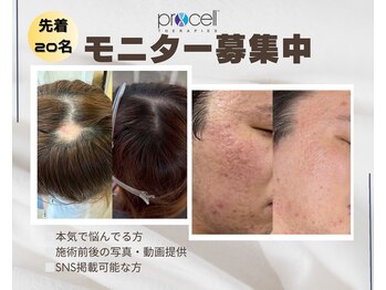 シール(Syl)/プロセルセラピーズ症例