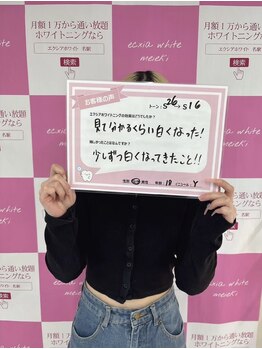 セルフホワイトニングサロン　エクシアホワイトニング宇治小倉店/お客様の声