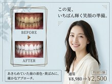 夏目ホワイトニングアンドネイル(夏目WHITENING＆NAIL)