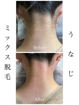 モア(more)/うなじワックス×最新光