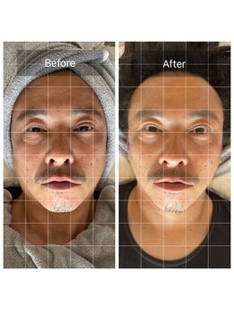 ジュエル シズオカ(JEWEL Shizuoka)/セルラムBefore After