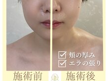 リコ(Rico)/即効性のある造顔マッサージ