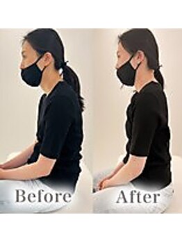 アマテル(AMATERU)/Before/After6