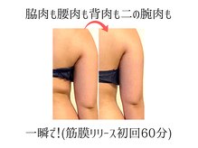 リーベ(Liebe)の雰囲気（一瞬で綺麗！でも戻るのも一瞬！施術だけでなく習慣からお手伝い）
